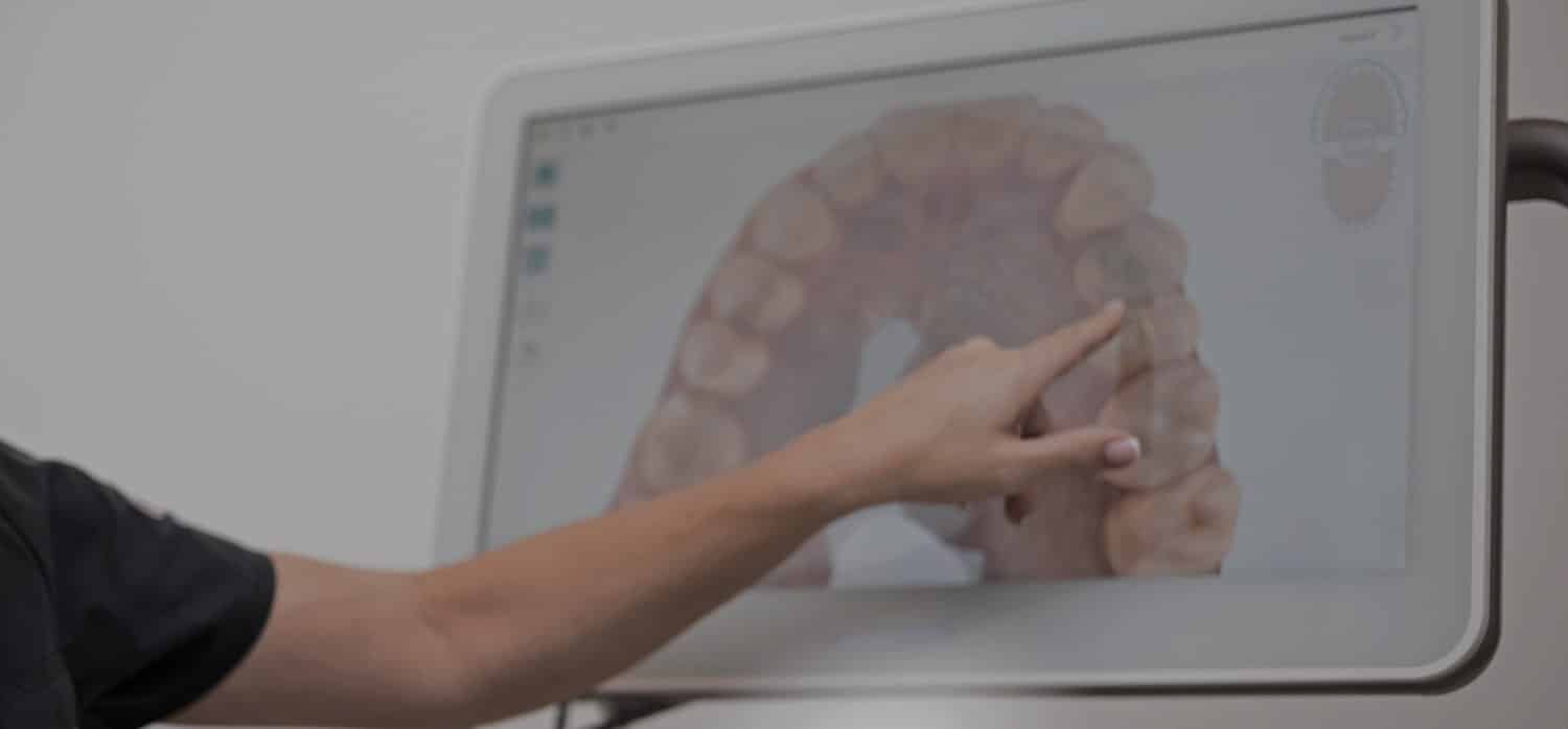 Dr. Alexandra Burnham pointing to dental xray