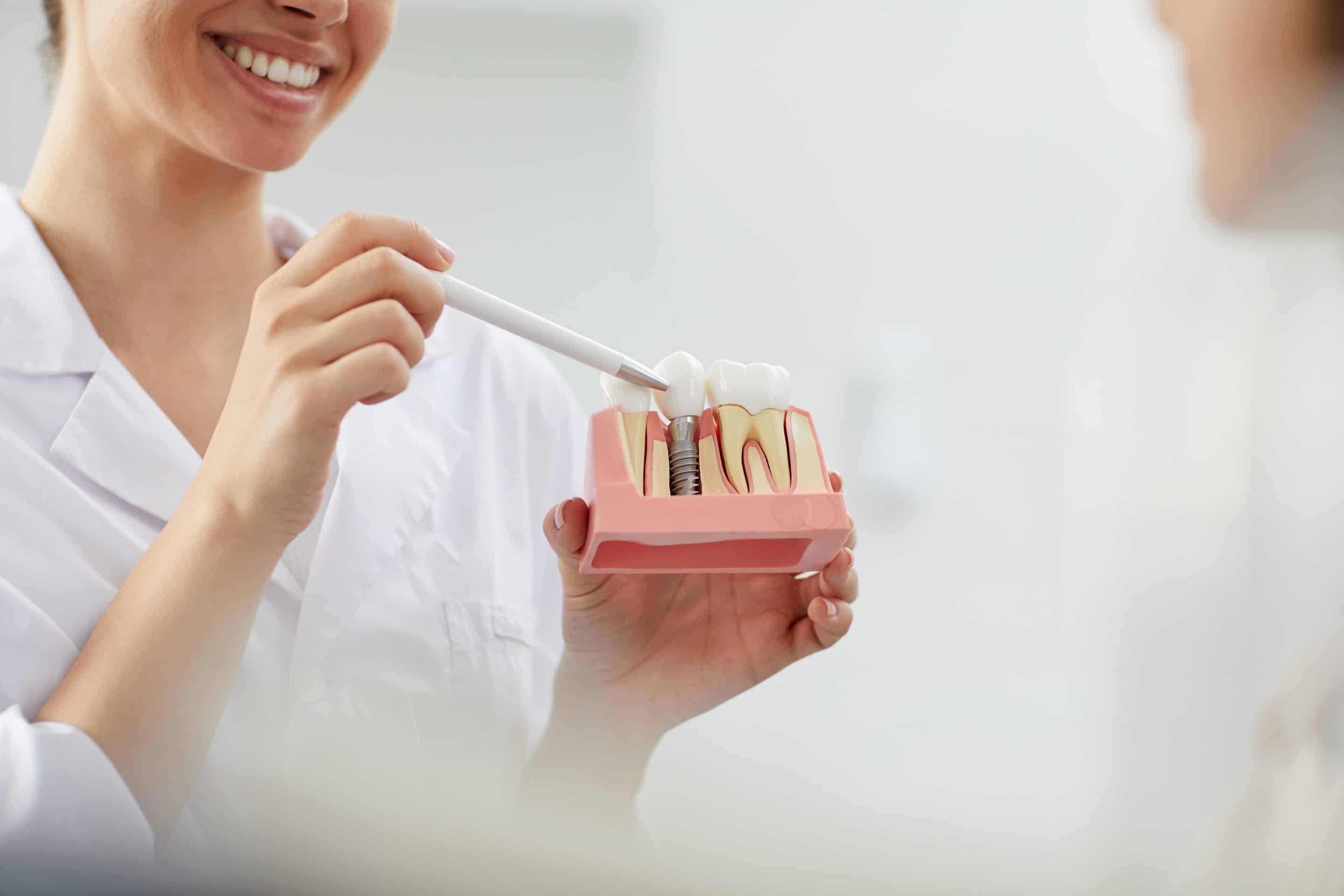 Dr. Alexandra Burnham pointing to a dental implant model during implant dentistry consultation at the smile studio