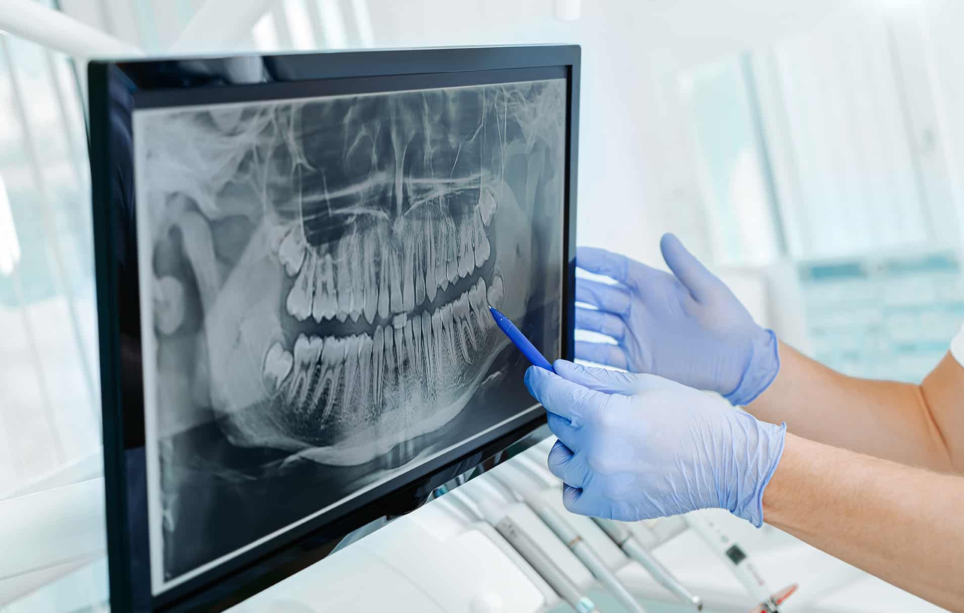 Dr. Alexandra Burnham pointing to dental xray at the smile studio