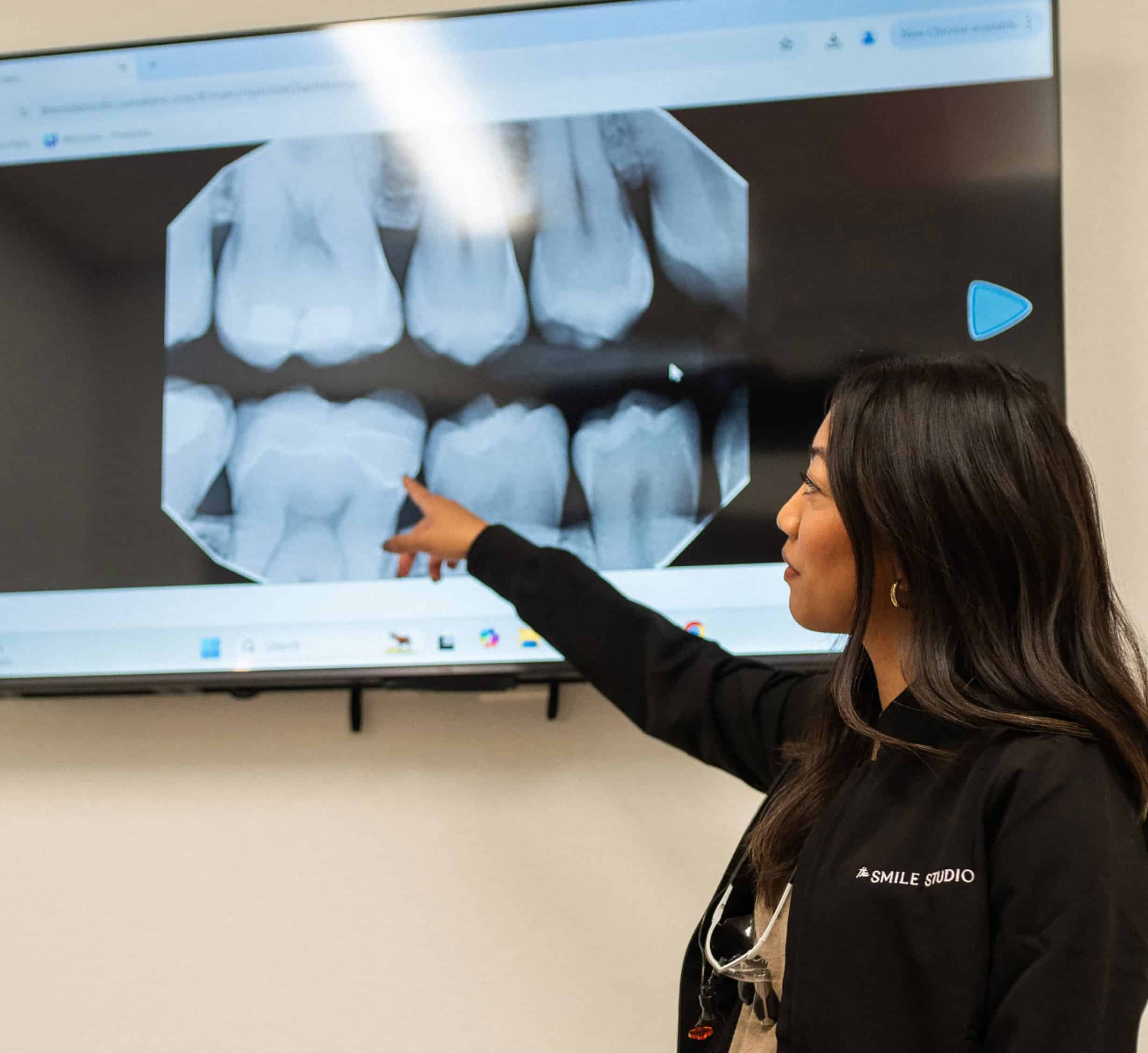 Dental crowns appointment in Phoenix, AZ