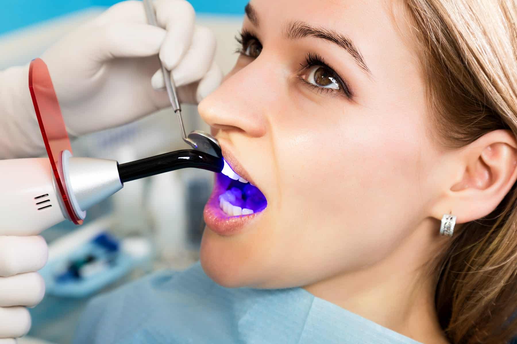 Dental bonding appointment in Phoenix, AZ